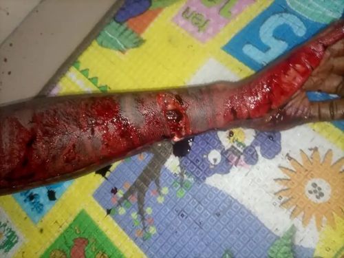 Police Arrest 23-Year-Old for Alleged Murder of Lover in Rivers